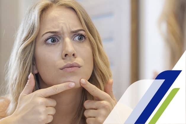 Espinillas en la cara Protex Guatemala